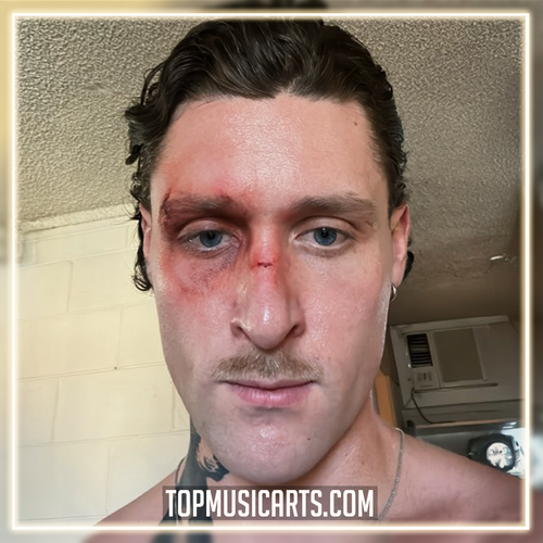 KETTAMA - It Gets Better Ableton Remake (Dance Pop)